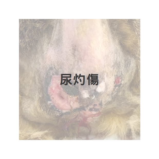 膀胱炎漏尿導致尿灼傷1.jpg