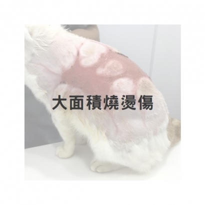 大面積嚴重燒燙傷1.jpg