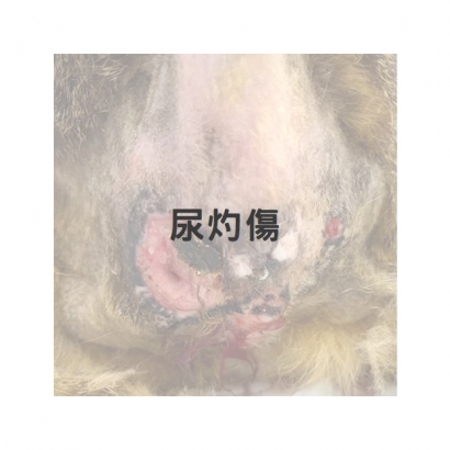 膀胱炎漏尿導致尿灼傷1.jpg