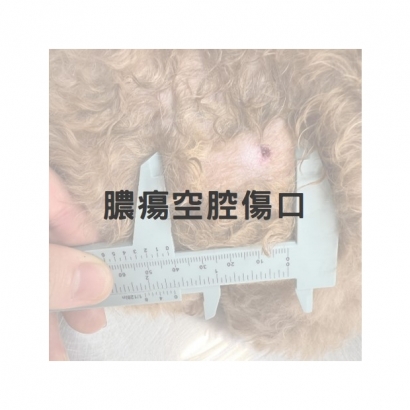 皮下膿瘍之空腔傷口_皮下硬塊1.jpg