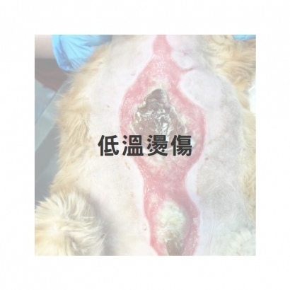 低溫燙傷1.jpg